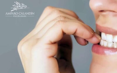 Onicofagia o el vicio de morderse las uñas